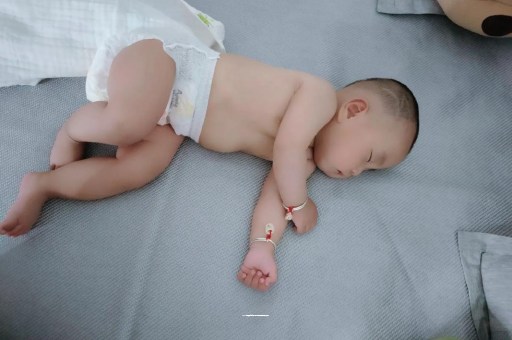 嘉峪关六个月宝宝眼睛散光